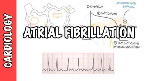 atrial fibrilation